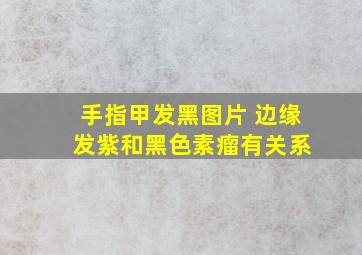 手指甲发黑图片 边缘 发紫和黑色素瘤有关系